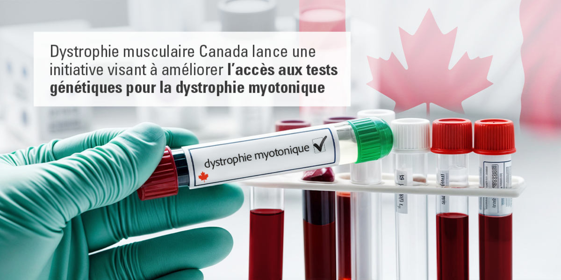 Dystrophie musculaire Canada lance une initiative visant à améliorer l'accès aux tests génétiques pour la dystrophie myotonique