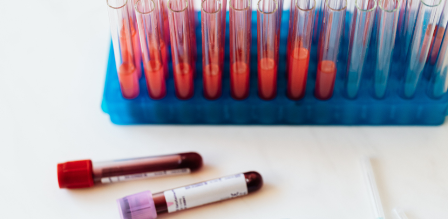 Laboratory test tubes filled with blood samples arranged in a rack, with two labeled blood vials lying on a white surface.